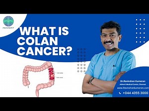 Colon Cancer Explained in Tamil | Colon Cancer Treatments | Dr.Ravindran Kumeran | Admert Hospital
