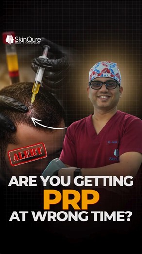 Are you getting PRP at the wrong time? | Dr Jangid Explained | #shorts