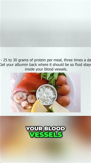 3-Week Edema Fix That Actually Works #swelling #healthtips #shorts