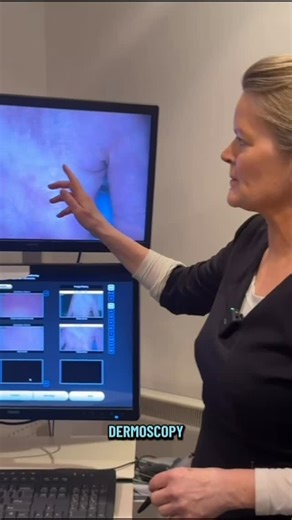 The Adare Clinic on Instagram: "Dr. Naomi discusses the diagnosis and treatment of hand dermatitis and scabies, with an excellent outcome achieved 🩺✨ . . . #scabies #dermatitis #dermatologist #reformskincare #skinhealth"