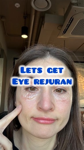 Laura Gomar on Instagram: "A few days ago, I went to @id_clinic_sinsa for an 𝐸𝑦𝑒 𝑅𝑒𝑗𝑢𝑟𝑎𝑛. ✨ 𝑹𝒆𝒋𝒖𝒓𝒂𝒏 𝒊𝒔 𝒇𝒐𝒓𝒎𝒖𝒍𝒂𝒕𝒆𝒅 𝒘𝒊𝒕𝒉 𝐒𝐚𝐥𝐦𝐨𝐧 𝐃𝐍𝐀 to stimulate skin healing and collagen production in the under-eye area, improving texture and reducing fine lines and dark circles. They also provided a translator, everything was explained clearly, and the procedure was very fast. It does hurt a bit, but it’s completely manageable, do not have to worry about 🫶🏻 📍 142 Dosa