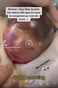 Un bébé dans la poche des eaux 😍 Contemplez les merveilles de Dieu à travers cette vidéo 🥰♥️ | Nelly M. Maman Nationale