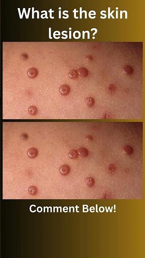 What is the following skin condition , comment below.!