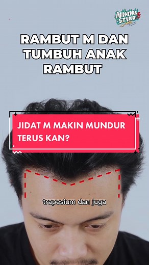 Gaya Rambut Terbaik untuk Jidat M