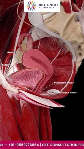 Managing Urinary Incontinence Post-Surgery
