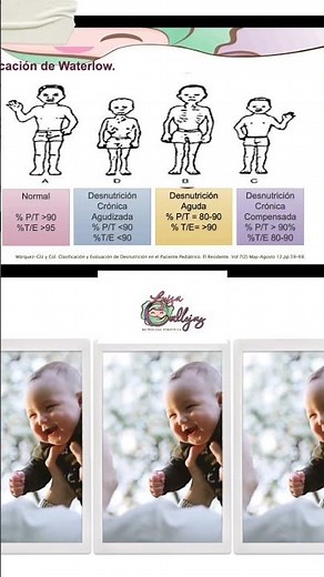 Clasificación de desnutrición por Waterlow. #nutriologos #nutricionista #nutricion