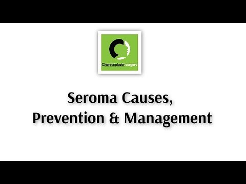 Seroma causes, prevention and management