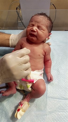 Infant of Diabetic Mother (IDM) Baby with Poor Sucking Reflex@cute baby @ NICU care@neonatal care