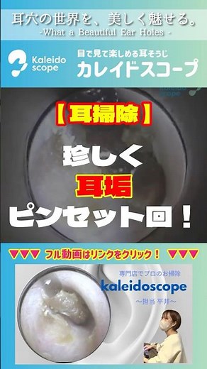 【耳掃除】珍しく耳垢ピンセット回！