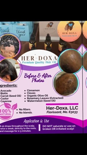 Her-Doxa & His-Eikón, Premium Quality Hair Oil, helps to stimulate hair follicles! 314) 358-8410
