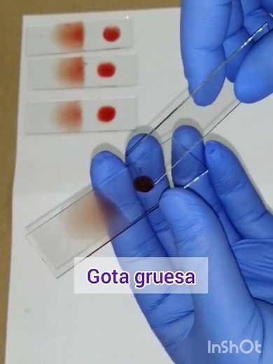 GOTA GRUESA Y EXTENDIDO FINO TÉCNICA GOTA REDONDA