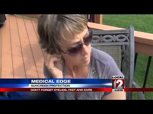 Medical Edge: Skin cancer where you don't expect