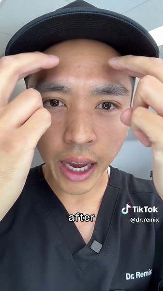 My eyes hurt and this helps 🙌 COMMENT if this helps you 🙌 #solareclipse #eclipse #solareclipse2024 #allergies #redeye #remedies #howto #tutorial #chiropractic #foryou #fyp