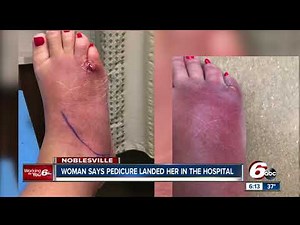 This Woman's Pedicure Horror Story Is The Worst We've Seen
