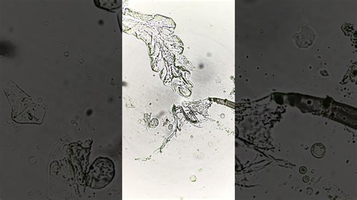 Bro Looks At A Drop Of Sweat Under A Microscope! Crazy Find!