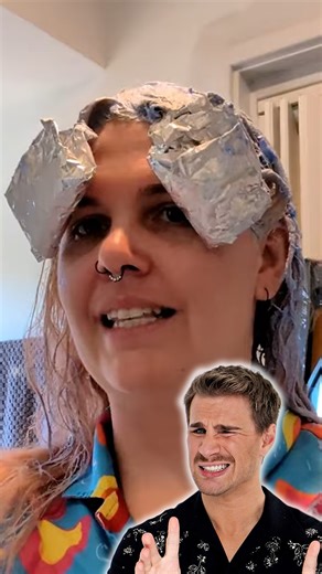 DIY Bleaching Ends with Chemical Burns🥶 | Brad Mondo