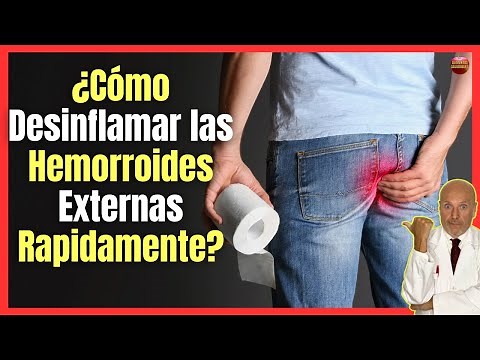🔴 ¿COMO DESINFLAMAR LAS HEMORROIDES EXTERNAS RAPIDAMENTE? 🔴