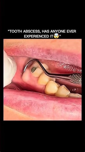 do you know about this??🤔 #cbum #toothless