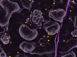A 'Bispecific Antibody' to Fight Crimean-Congo Hemorrhagic Fever | Microbiology