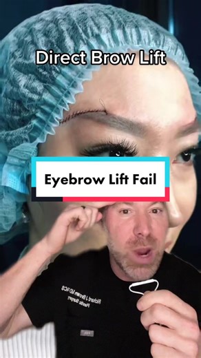 Avoid Eyebrow Lift Mistakes with these Tips