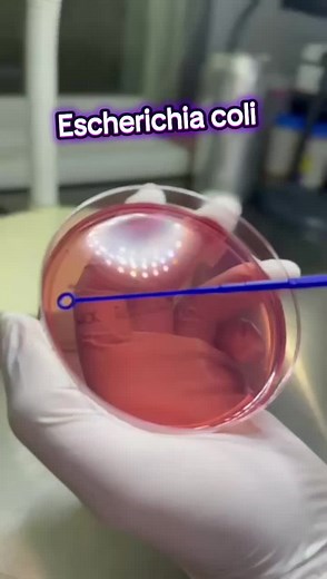 Escherichia coli: ¿Qué es y cuáles son sus efectos?