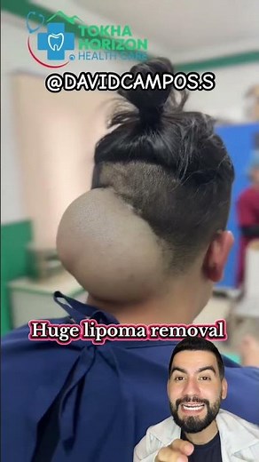 FAT MASS IN THE NECK