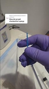 how do we diagnose uterine polyps with sonohysterogram water ultrasound