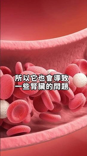#迷思 #營養師 喝珍奶傷腎？揭秘洗腎主因！