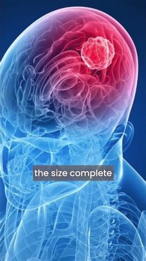Can a Brain Tumour Be Removed Completely