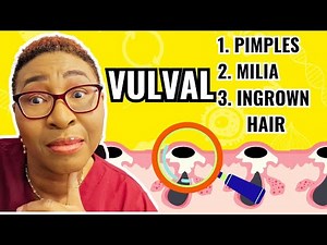 How To Treat 3 Common Vulval Lumps