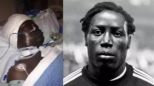 Jean-Pierre Adams: The footballer who spent 39 years in a coma after a surgery went wrong