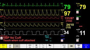 Simulated Patient Monitor on Make a GIF