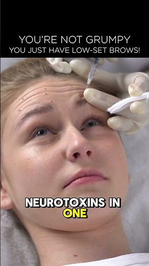 Brow lift surgery: How your brows affect facial expression