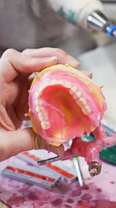 Join Aspen Dental to be part of a team of dental experts. We use cutting-edge technology to transform denture design with these steps: 1. Scan: Capture a digital 3D scan for a precise fit. 2. Design: Use advanced tech and top-quality materials for exact measurements. 3. Try On: Preview your new smile—75% of patients get their dentures the same day, with minimal adjustments. #AspenDental #dentaltech #dentalcareer #dentist | Life at Aspen Dental | Facebook