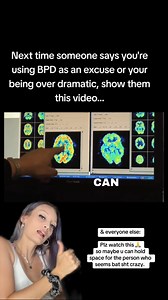 Getting rewired is required. 👀 & that’s possible with ✨meditation (frequencies, chakras, giving peace to your nervous system) , ✨somatic breath & movement, ✨EMDR, ✨eft tapping (on yt for working on your subconscious mind while utilizing Chinese medicine acupressure points & releasing happy chemicals) , etc. Let’s keep on healing!!! ❤️‍🩹 #bpd #borderlinepersonalitydisorder #mentalhealth | 𝔦𝔡𝔞𝔥𝔬𝔩𝔦𝔰𝔱𝔦𝔠