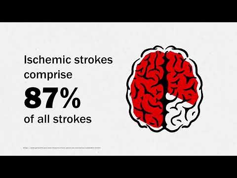 Enhanced FAST ED Stroke Assessment