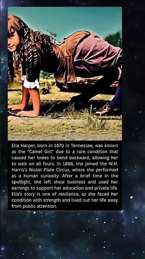 The Camel Girl Who Walked on All Fours – Ella Harper’s Incredible Story