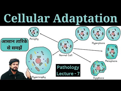 Cellular Adaptation - Atrophy, Hypertrophy, Hyperplasia, Metaplasia & Dysplasia || Pathology Lecture