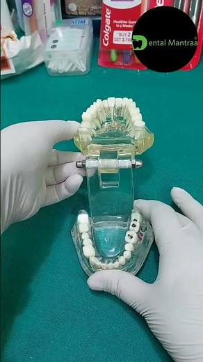 ”“Complete Guide: Extraction Forceps”“Dental Tool: Extraction Forceps Overview”#dentalartistry #yt