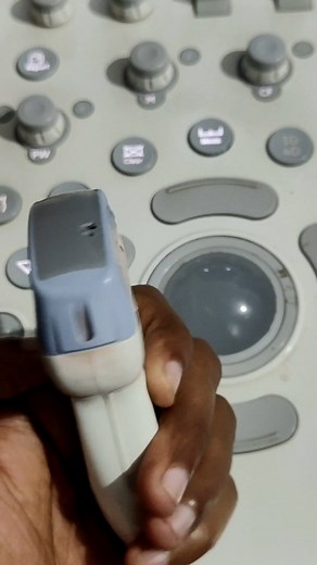 36K views · 67 reactions | @highlight Technician Job Ultrasound learnig and knowledge sharing Drx Manoj Thakur Facebook #viralreelschallenge2025viralreelschallengejaiviralreelschallengeviralreelschallenge #ultrapanda #ultrasoundtechnician #sonographyeducation | Technician Job | Facebook