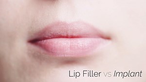 Lip Augmentation vs. Fillers: Which is Better for Your Lips?