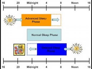 Advanced Sleep Wake Phase Disorder (circadian rhythm sleep disorder) ; Causes, Symptoms, Treatment