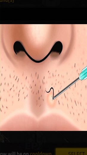 23K views · 80 reactions | Asmr treatment 2025 | Trending Videos | Facebook