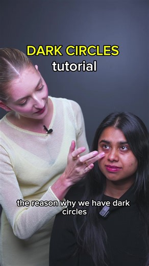 Effective Dark Circles Treatment with Face Yoga