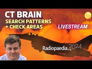 Brain CT: search patterns and check areas with Andrew Dixon
