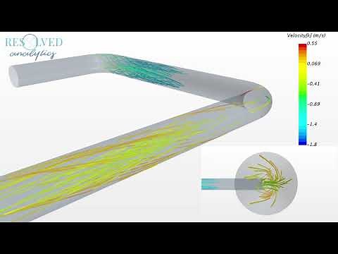 CFD Simulation of Dean Vortices in Pipe