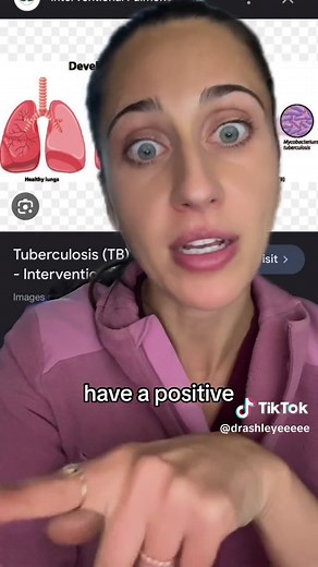 Understanding TB Tests: Symptoms, Diagnosis, and Treatment
