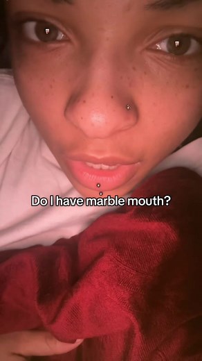 Understanding Marble Mouth: Do You Have It?