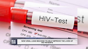 2.8K views · 18 reactions | Health Minister Dr. Frank Atnhony on Friday admitted that there are issues with conducting viral load testing for people living with HIV in Guyana and as such he disclosed that a new machine has been procured to address the shortcoming. With this machine, patients can ascertain the efficacy of their treatment and monitor any changes in the virus. Dr Anthony further noted that while viral load testing can be accessed privately it is costly. | News Room | Facebook