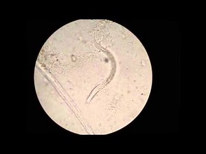 Enterobius vermicularis